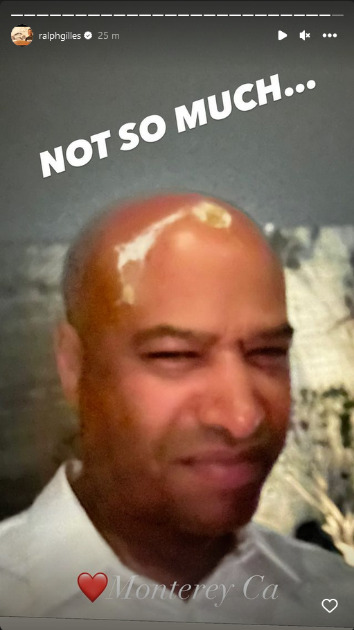 image.png.3de9f19b3c651cbf2ec9267fa2efb3c4.png